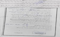 عملیات احیای قلبی ریوی در کنار خیابان / جان دوباره با تلاش نفس‌گیر کارشناسان اورژانس آذربایجان‌غربی